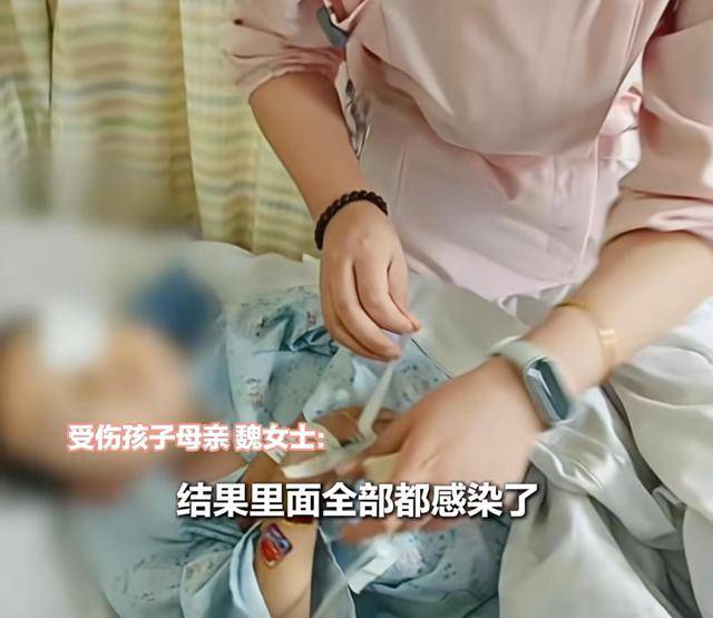 英格兰 vs 威尔士_江西一5岁男孩在幼儿园被戳伤致左眼失明英格兰 vs 威尔士，家长称老师用猪油涂抹试图消肿